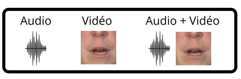 Le cortex auditif – Speechneurolab