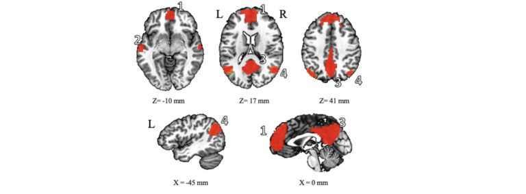 The Brain (1969) ( Le cerveau ) [ NON-USA FORMAT, PAL, Reg.0 Import -  France ] 