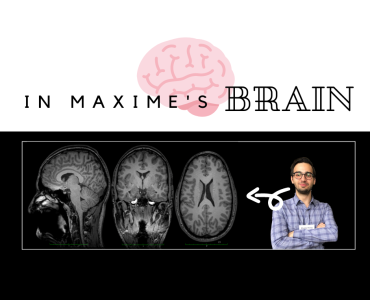 Thumbnail - cerveau de Maxime_ENG