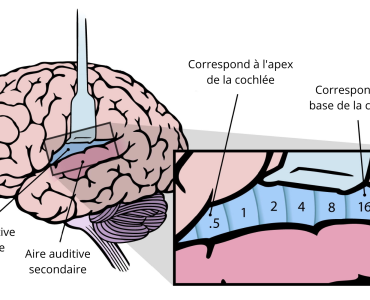 blogue-_cortex_auditif
